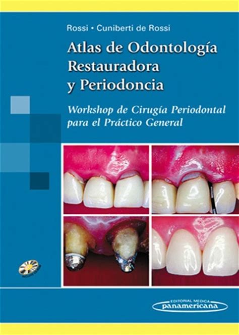 Atlas de Odontología Restauradora y Periodoncia: Workshop ...