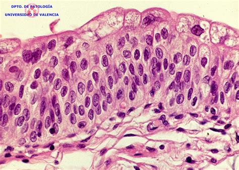 Atlas virtual de histologia e patologia: [CC #13 ...