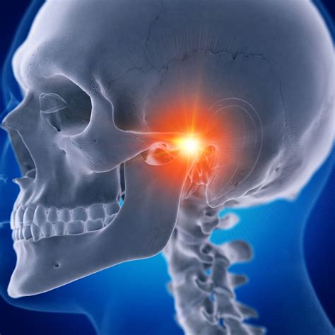 ATM, efectos secundarios a la mala movilidad de la mandíbula