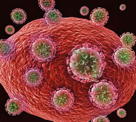 B Cell Lymphomas Now Lead Cause of Death Among HIV ...