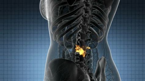 Backache in Back Bones | Backache, Human spine, Bones