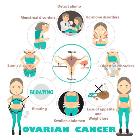 BE AWARE OF THE FOUR MAIN SYMPTOMS OF OVARIAN CANCER: | My ...