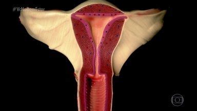 Bem Estar | Câncer de ovário não tem sintomas na fase ...