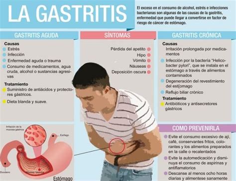 Beneficios de la Cúrcuma para la Gastritis