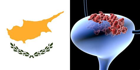 Bladder Cancer in Cyprus