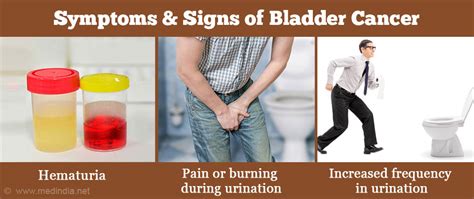 Bladder Cancer – Symptoms, Signs, Diagnosis, Treatment ...