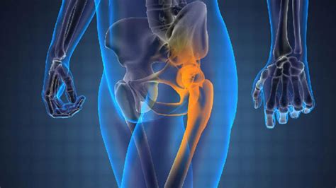 Bone cancer rare but dangerous, says physician — Features ...