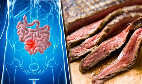 Bowel cancer warning: THIS factor may fuel disease – it ...
