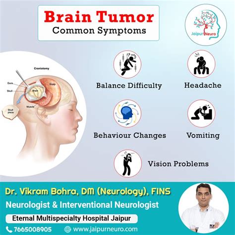 Brain Tumor Common Symptoms | Neurologist, Neurologist ...