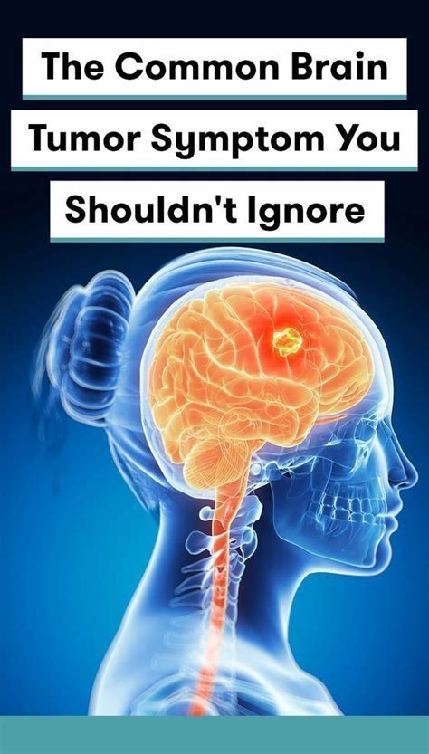 BRAIN TUMORS COME IN DIFFERENT SHAPES AND SIZES, SO THEIR ...