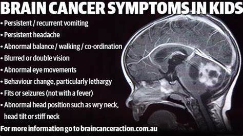 Brain tumours are the biggest cancer killer of children ...