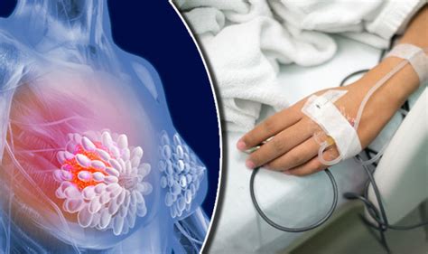 Breast cancer signs: Third of those diagnosed have ...
