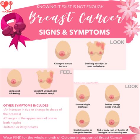 Breast Cancer : Symptoms and Signs. Lets bust the myth!