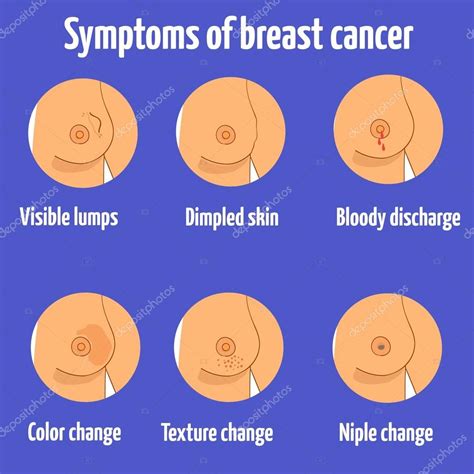 Breast cancer symptoms. Vector illustration. Different ...