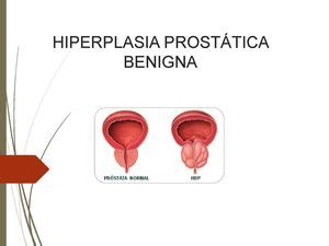 Calaméo   Hiperplasia Prostática Benigna