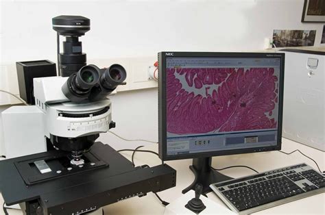 Camara Digital para microscopio   Luvicorp Medical