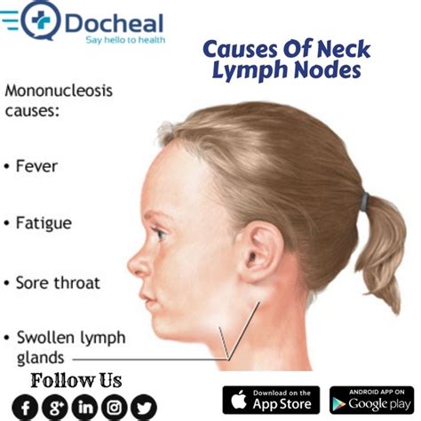 Can a common cold cause neck lymph nodes?   Quora