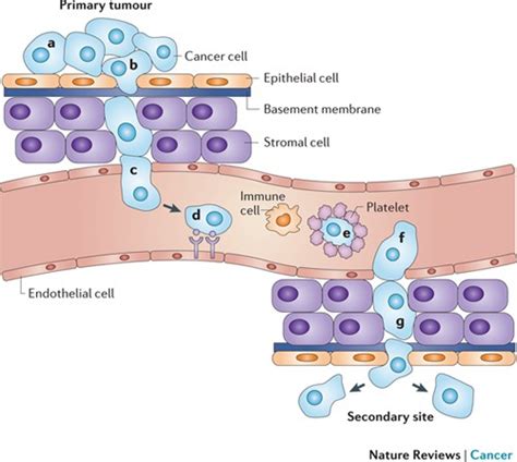 Cancer Cell, Blood Vessel, Normal Cell, Invasive Carcinom...