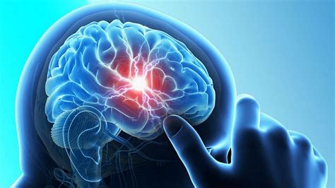Cáncer cerebral sus causas y síntomas – Periódico Sin ...