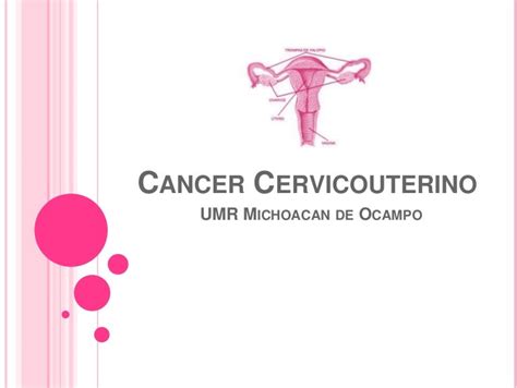 Cancer Cervicouterino