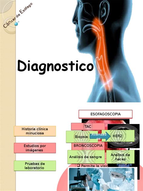 Cancer de Esofago diagnostico y tratamiento ...