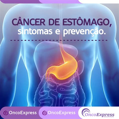 Câncer de estômago, sintomas e prevenção   OncoExpress