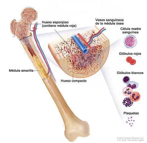 Cáncer de hueso—Versión para pacientes   National Cancer ...