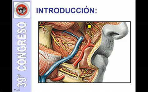 Cáncer de labio inferior   YouTube