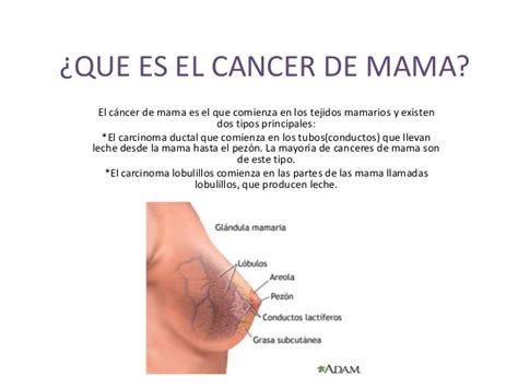 Cancer de mama!