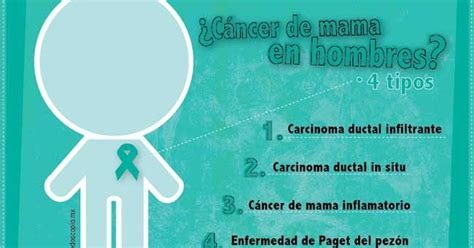 CANCER DE MAMA : SINTOMAS DEL CANCER DE MAMA EN HOMBRES