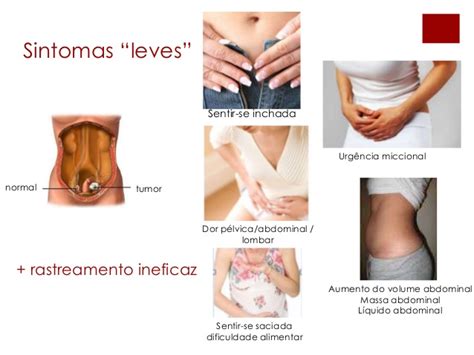 Cancer De Ovarios Sintomas Iniciales   SEONegativo.com
