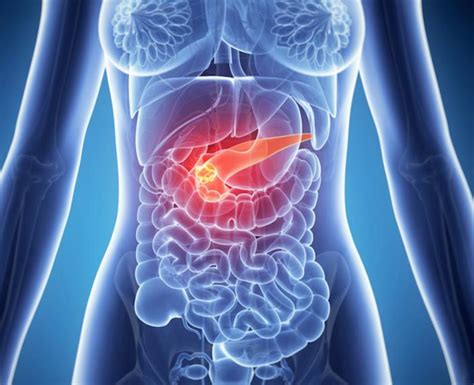 Cáncer de páncreas: qué es, causas, síntomas y tratamiento