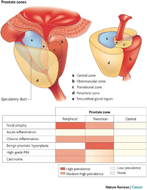 Cáncer de próstata: anatomía