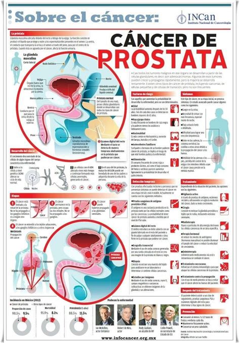 Cancer de próstata | Cáncer de próstata, Consejos para la salud ...