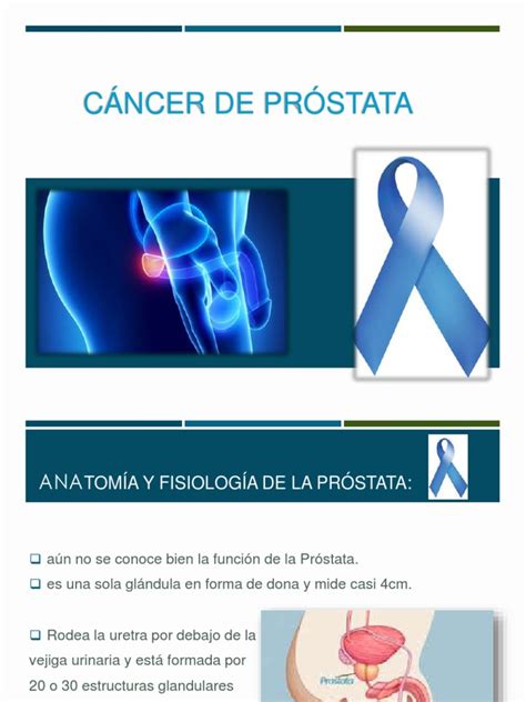 Cáncer De Próstata | Cancer de prostata | Metástasis | Prueba gratuita ...