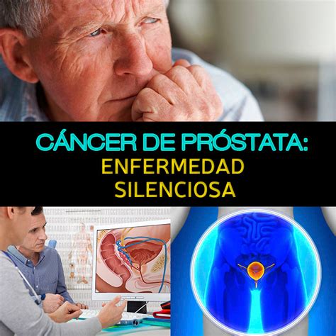 Cáncer de próstata: causas, síntomas y tratamiento | La ...
