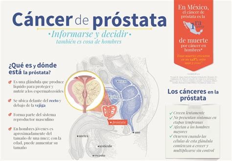 Cáncer De Próstata: Enfermedad Silenciosa | Nación Farma: Salud Y ...