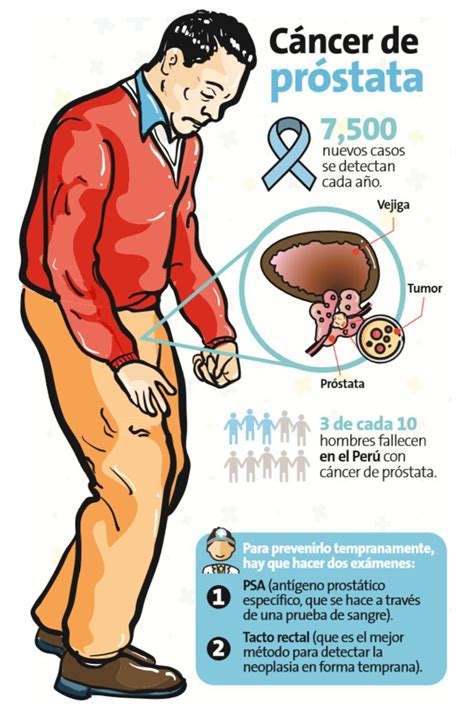 Cáncer de próstata es el que más crece Salud | Peru21