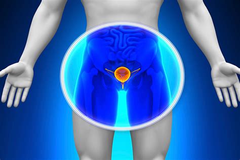 Cáncer de próstata: guía radiológica de diagnóstico y ...