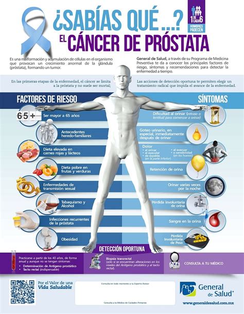 Cáncer de próstata [Infografía] | INSteractúa