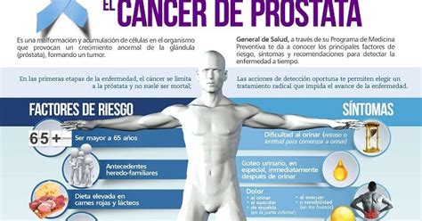 Cáncer de próstata [Infografía] | INSteractúa