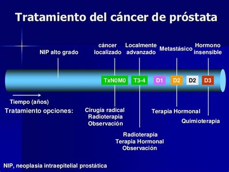 Cáncer De Próstata