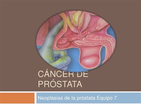 Cancer De Prostata