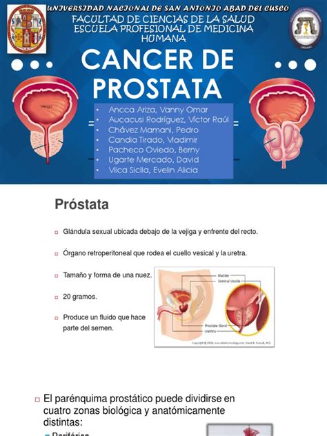 Cancer de Prostata Patologia | Antígeno específico de la próstata ...