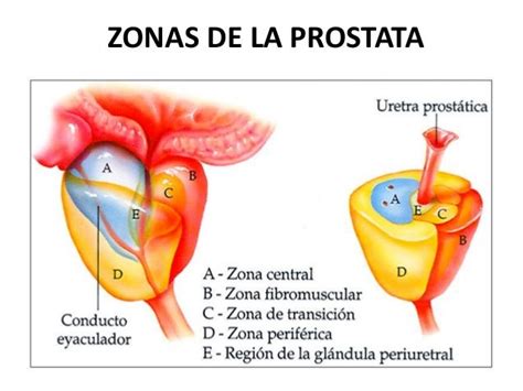Cancer de prostata smr