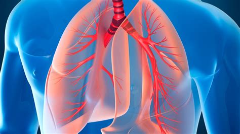 Cáncer de pulmón: buscan expandir una técnica para su ...