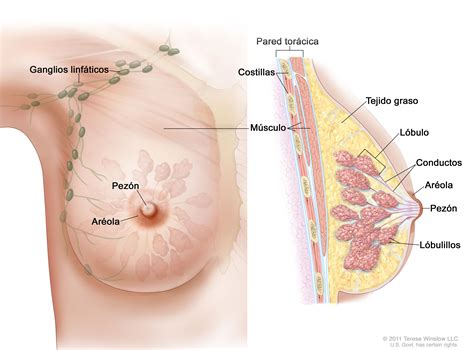 Cáncer de seno  mama —Versión para pacientes   National ...