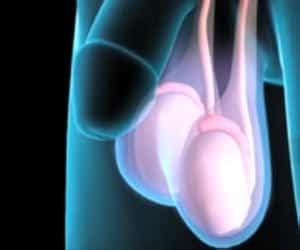 Cáncer de testículos o testiscular   Causas, síntomas, TODA la info aquí