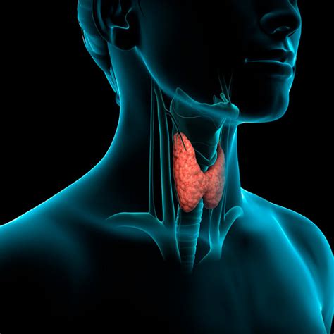 Cáncer de tiroides: causas, síntomas, diagnóstico y ...