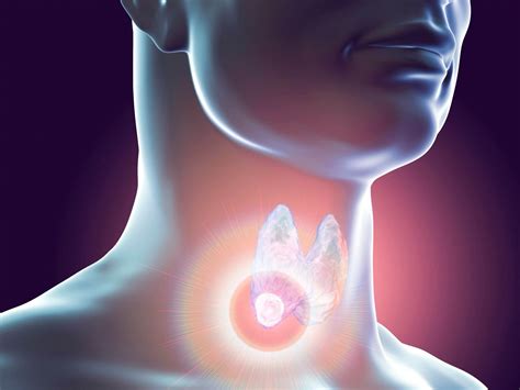 Cáncer de tiroides: preguntas y respuestas para estar ...